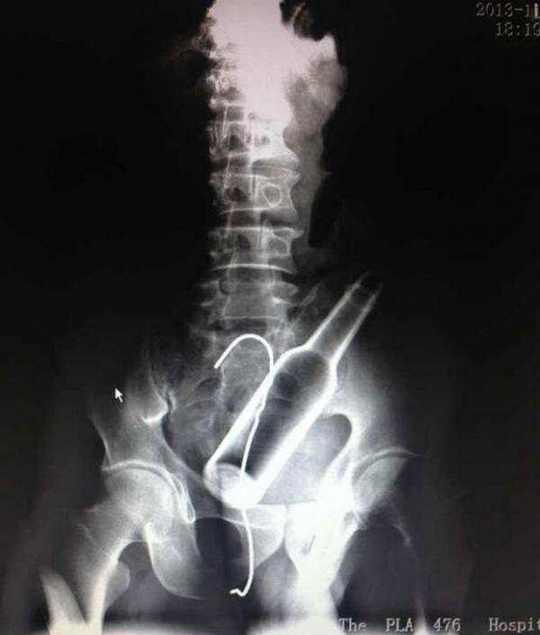 radiografie imbarazzanti radiografie imbarazzanti