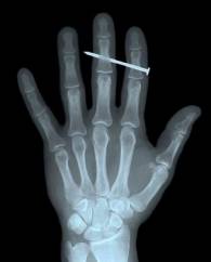 radiografie imbarazzanti