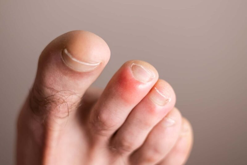 geloni piedi