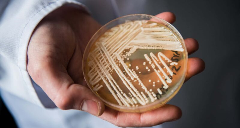 Candida auris: cos’è e come si manifesta