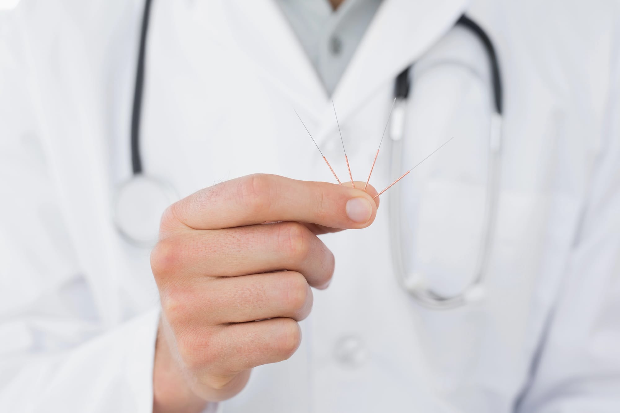 medico agopuntura